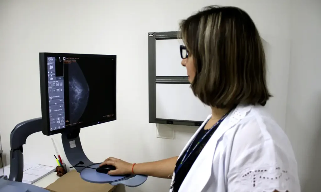 Planos devem estimular mamografias para receber atestado de qualidade