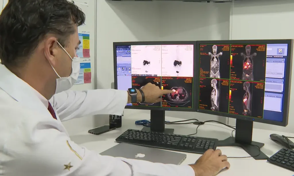 Rastreamento de câncer de intestino identifica lesões em 231 pacientes