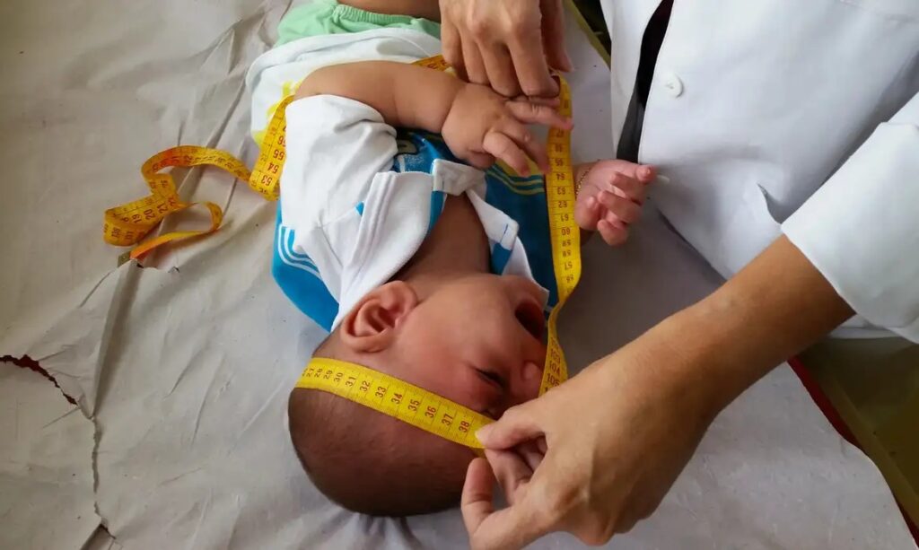 INSS pagará indenização de R$ 60 mil a crianças vítimas de zika vírus