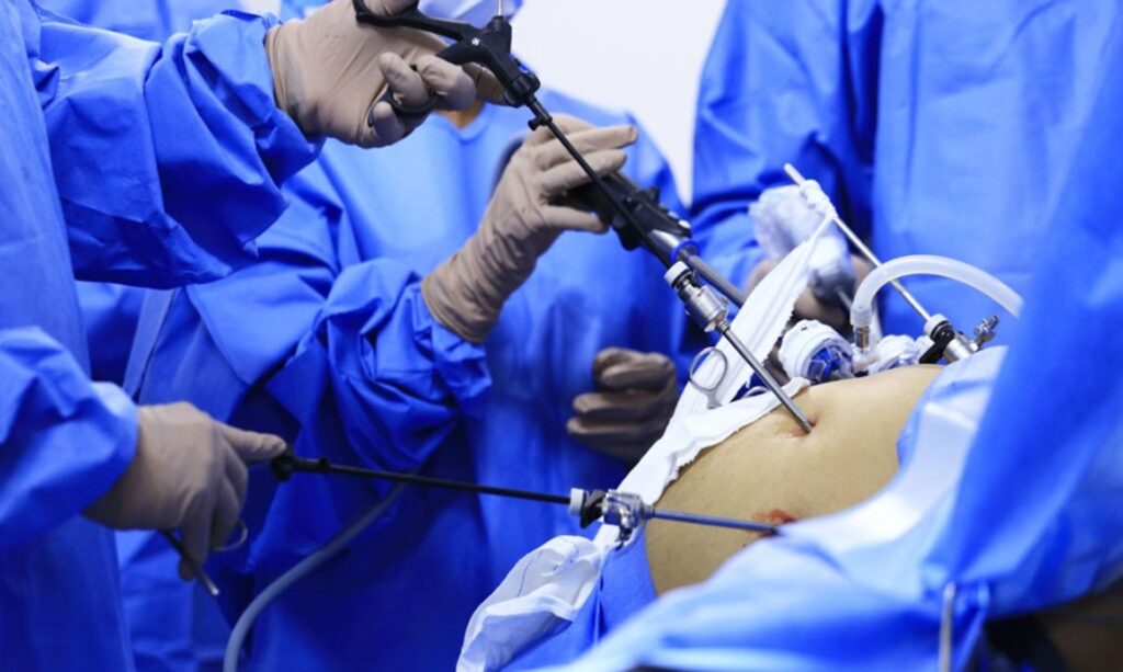 SUS realiza apenas 10% das cirurgias bariátricas no Brasil, mesmo com CFM ampliando critérios