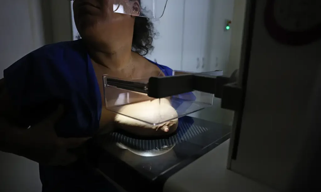 ANS propõe ampliar cobertura de mamografia digital para todas as idades e gêneros com indicação médica