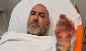 Henrique Fogaça relata acidente de moto, mostra ferimentos e denuncia roubo de aliança em hospital