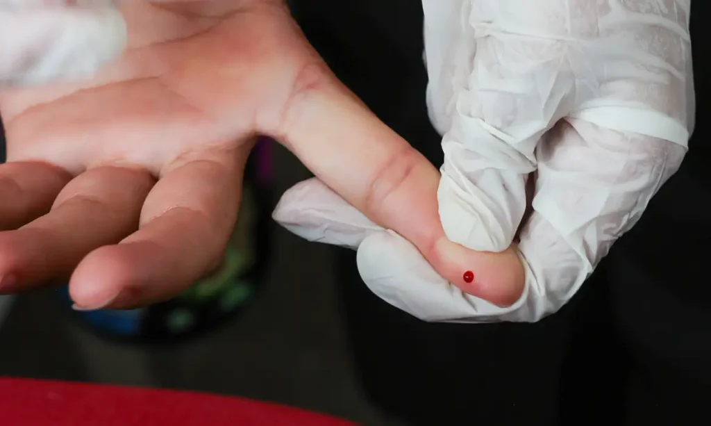 Brasil atinge meta de eliminação da transmissão vertical da hepatite B e pede certificação à Opas 1 Brasil atinge meta de eliminação da transmissão vertical da hepatite B e pede certificação à Opas